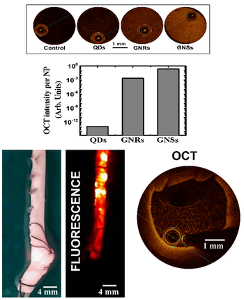 scientific image referred to optical coherence tomography